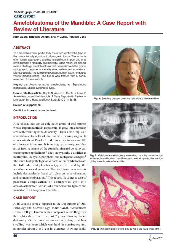 (PDF) Ameloblastoma of the Mandible A Case Report with Review of