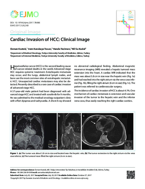 (PDF) Cardiac invasion of HCC: Clinical image