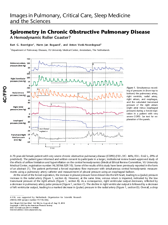 (PDF) Spirometry in Chronic Obstructive Pulmonary Disease