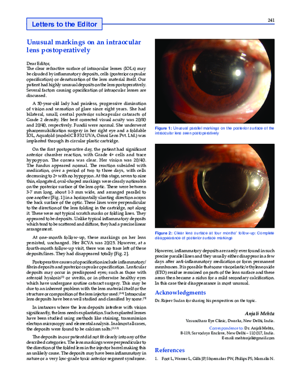 (PDF) Unusual markings on an intraocular lens postoperatively