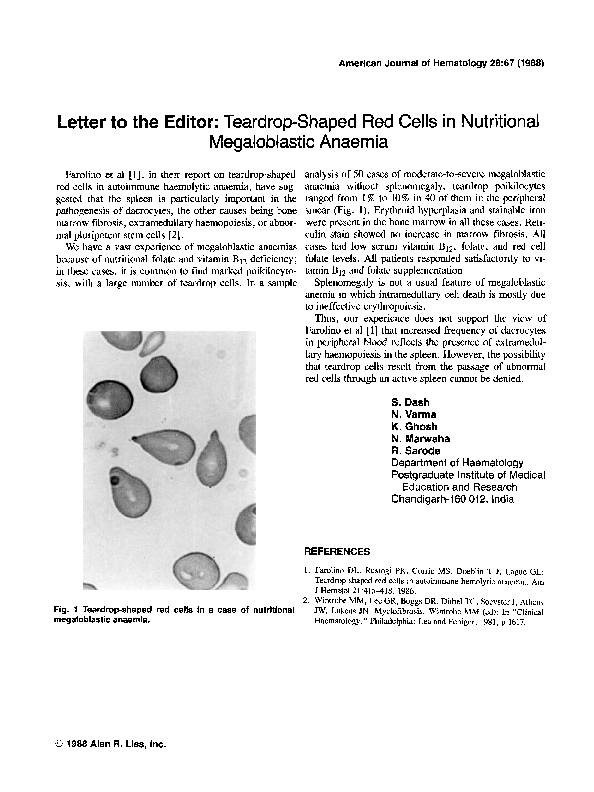 Teardrop Shaped Red Blood Cells