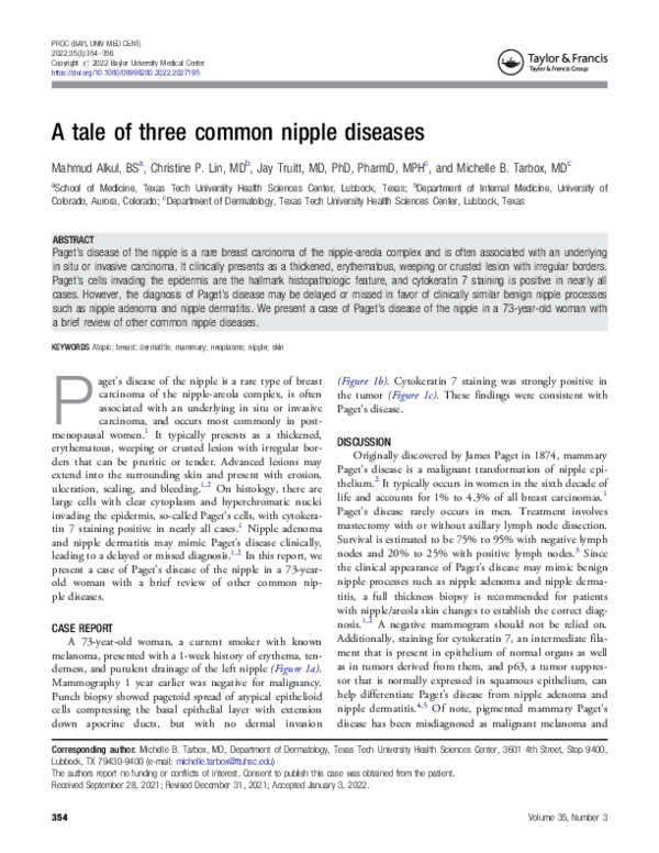 (PDF) A tale of three common nipple diseases Michelle Tarbox