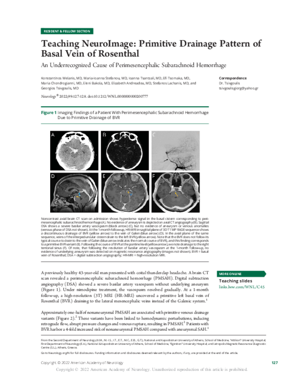 (PDF) Teaching NeuroImage: Primitive Drainage Pattern of Basal Vein of ...