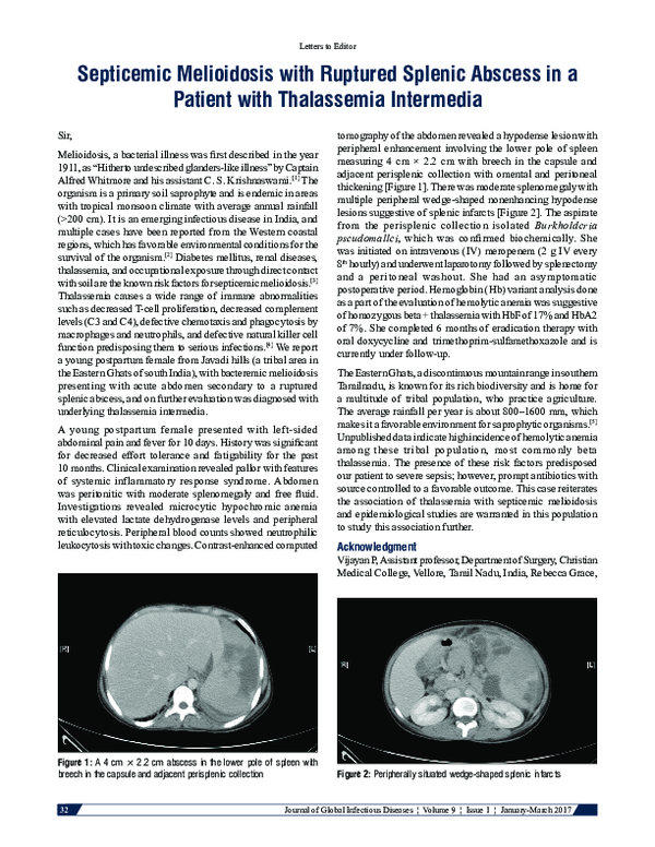 (PDF) Septicemic melioidosis with ruptured splenic abscess in a patient ...