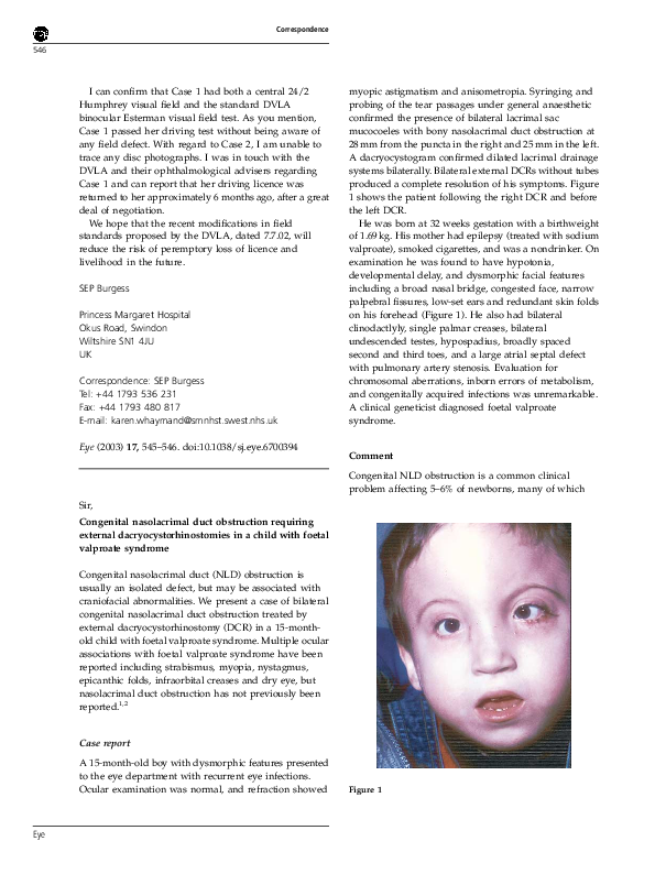 (PDF) Congenital nasolacrimal duct obstruction requiring external ...