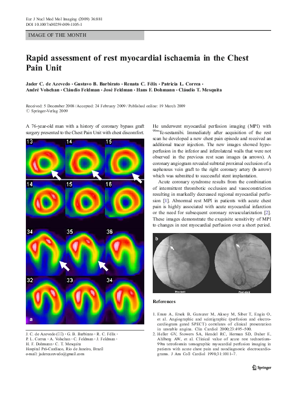 (PDF) Rapid assessment of rest myocardial ischaemia in the Chest Pain Unit
