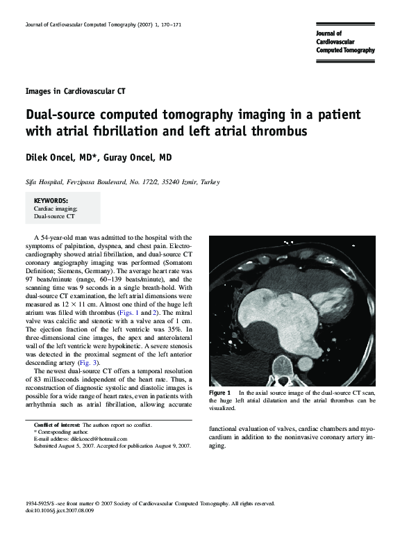 (PDF) Dual-source computed tomography imaging in a patient with atrial ...