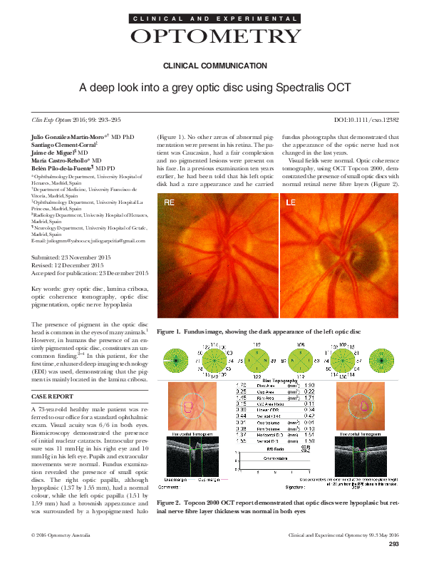 (PDF) A deep look into a grey optic disc using Spectralis OCT