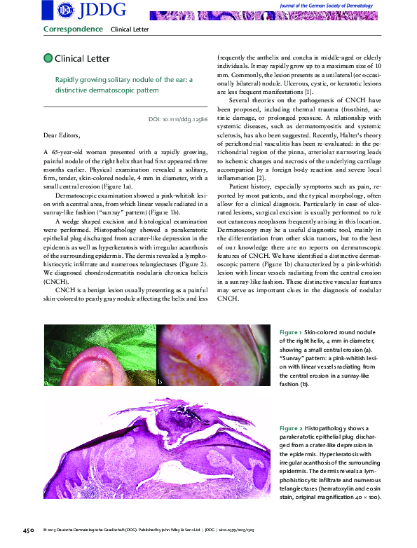(PDF) Rapidly growing solitary nodule of the ear: a distinctive ...