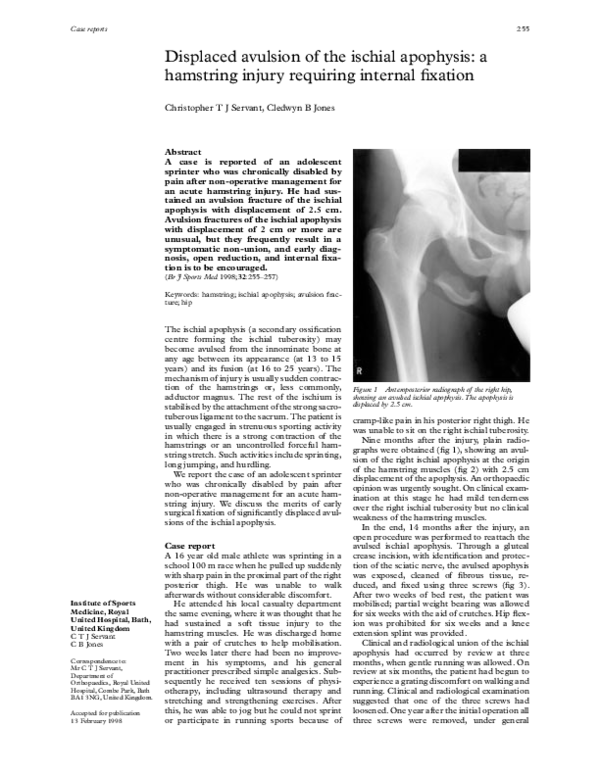 (PDF) Displaced avulsion of the ischial apophysis: a hamstring injury ...