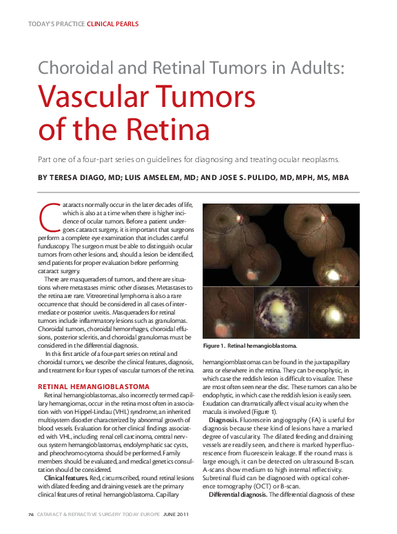 (PDF) Choroidal and Retinal Tumors in Adults: Vascular Tumors of the ...