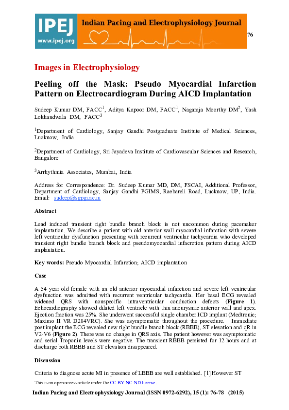 (PDF) Peeling off the Mask: Pseudo Myocardial Infarction Pattern on ...