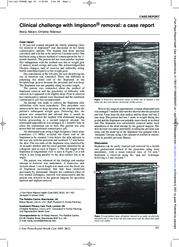 (PDF) Clinical challenge with Implanon® removal: a case report