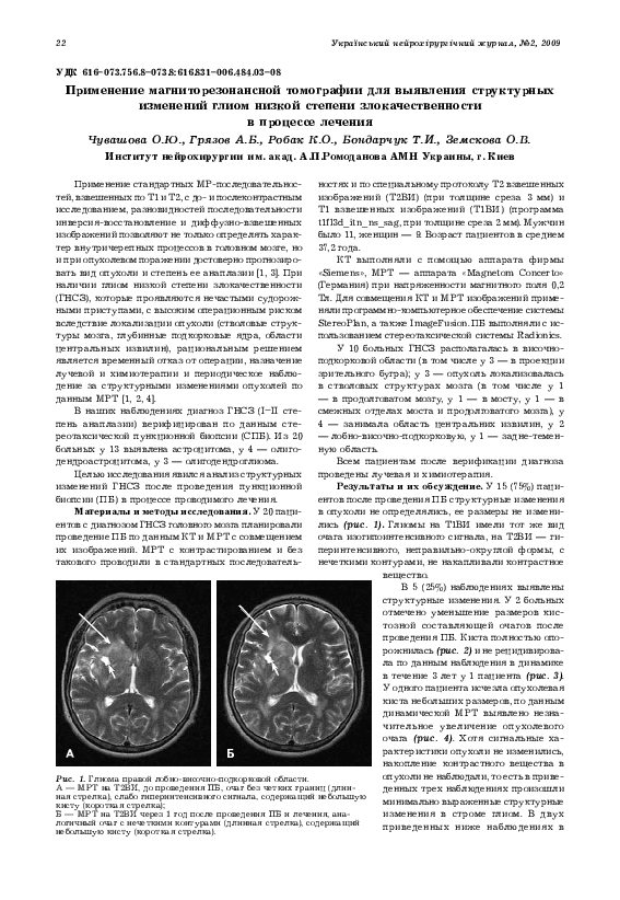 (PDF) Magnetic resonance imaging application for exposure of structural ...