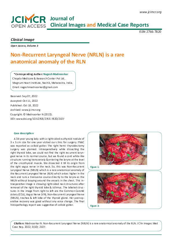 (PDF) Non-Recurrent Laryngeal Nerve (NRLN) is a rare anatomical anomaly ...