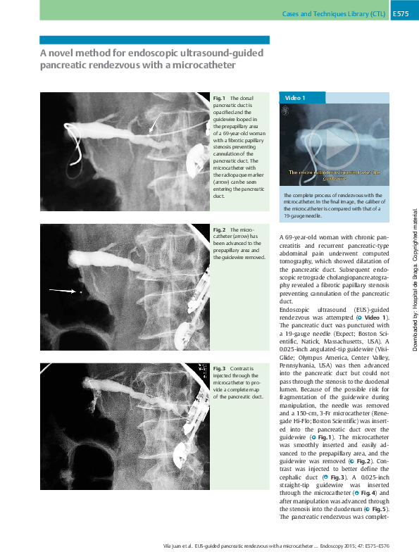 (PDF) A novel method for endoscopic ultrasound-guided pancreatic ...