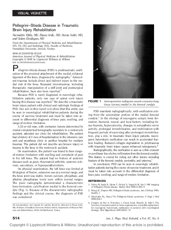 (PDF) Pellegrini–Stieda Disease in Traumatic Brain Injury Rehabilitation