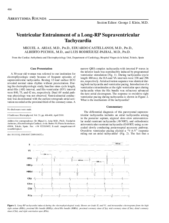 (PDF) Ventricular Entrainment of a Long-RP Supraventricular Tachycardia