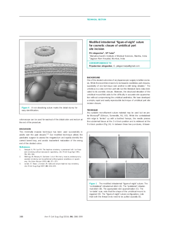 (PDF) Modified intradermal ‘figure-of-eight’ suture for cosmetic ...