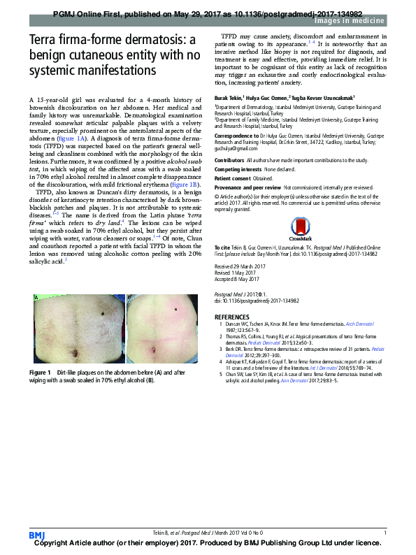 (PDF) Terra firma-forme dermatosis: a benign cutaneous entity with no ...