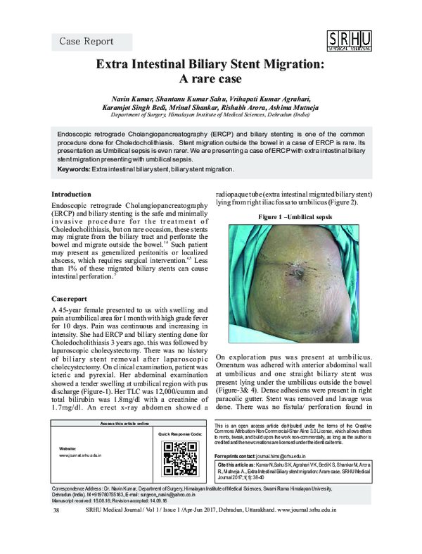 (PDF) Extra Intestinal Biliary stent migration: A rare case