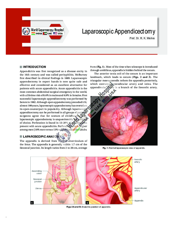 (PDF) Laparoscopic Appendicectomy: A Minimally Invasive Approach to ...