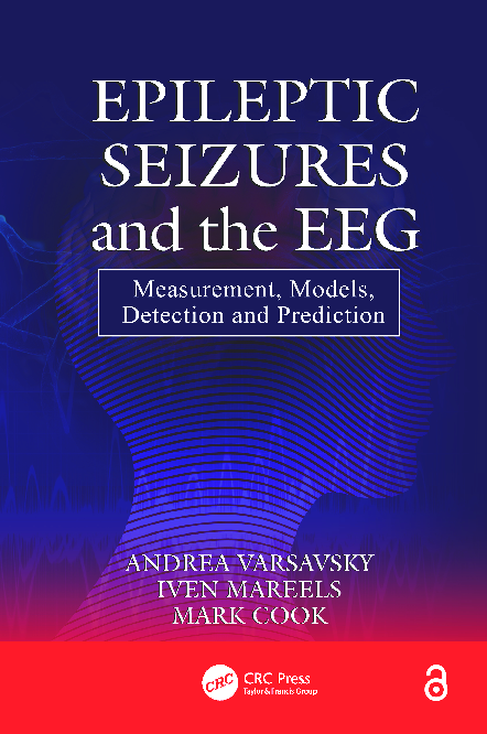 (PDF) Epileptic Seizures and the EEG