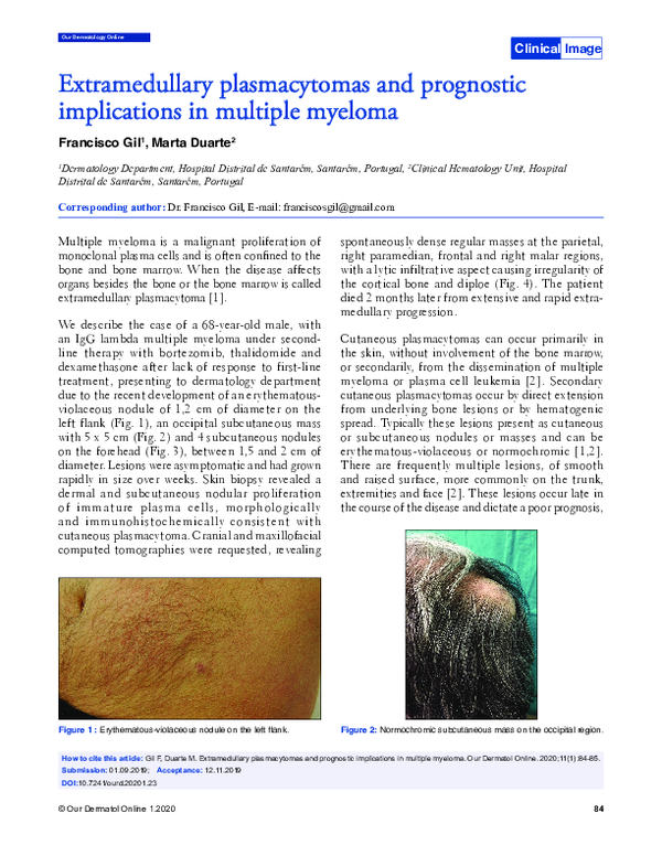 (PDF) Extramedullary plasmacytomas in the context of multiple myeloma