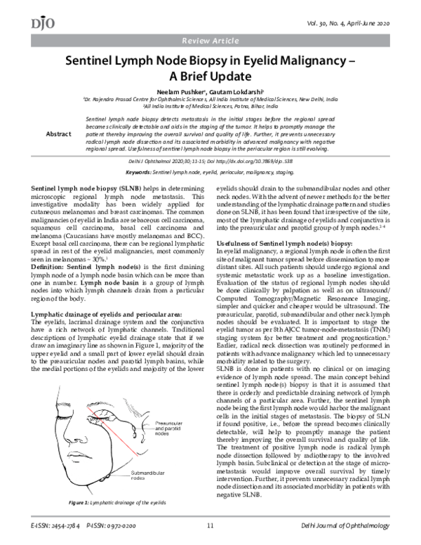 (PDF) Sentinel Lymph Node Biopsy in Eyelid Malignancy – A Brief Update