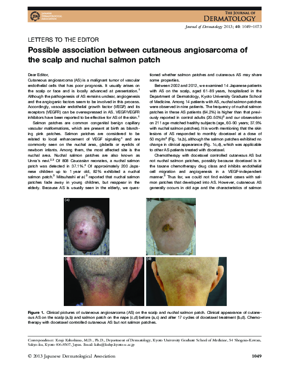 (PDF) Possible association between cutaneous angiosarcoma of the scalp ...