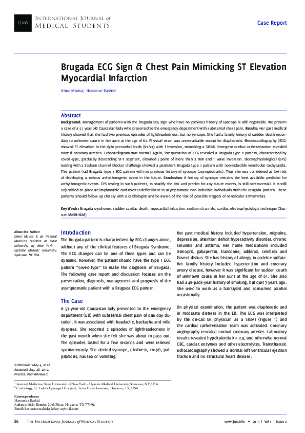 (PDF) Brugada ECG Sign Chest Pain Mimicking ST Elevation Myocardial ...