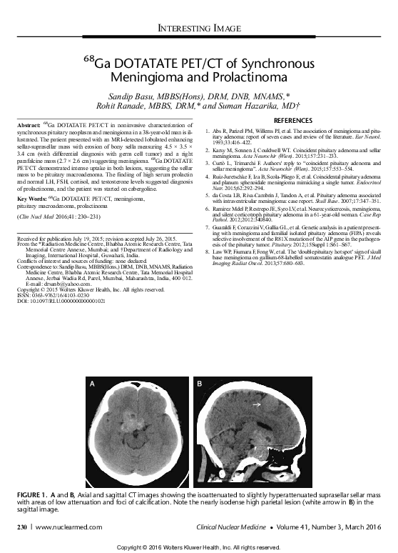 (PDF) 68Ga DOTATATE PET/CT of Synchronous Meningioma and Prolactinoma