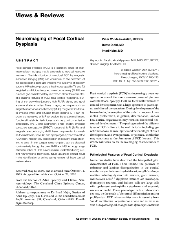 (PDF) Neuroimaging of Focal Cortical Dysplasia