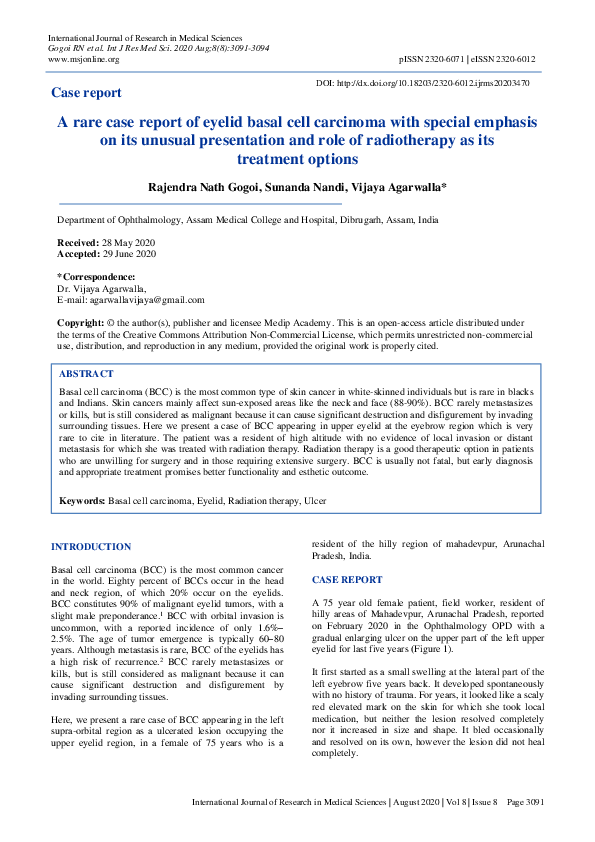 (PDF) A rare case report of eyelid basal cell carcinoma with special ...