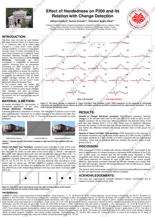 (PDF) Effect of handedness on P200 and its relation with change detection
