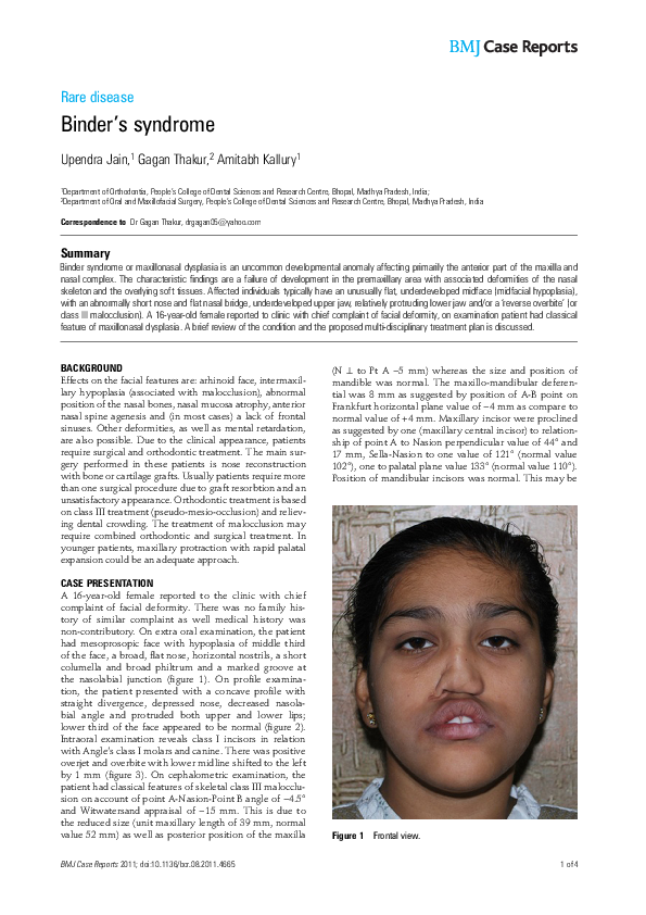 (PDF) Binder's syndrome