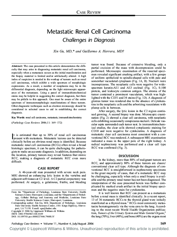 (PDF) Metastatic renal cell carcinoma