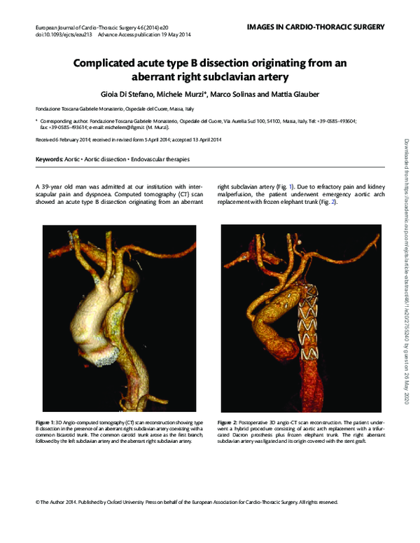 (PDF) Complicated acute type B dissection originating from an aberrant ...