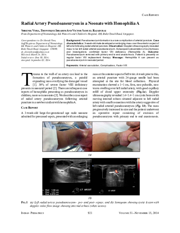 (PDF) Radial artery pseudoaneurysm in a neonate with hemophilia A