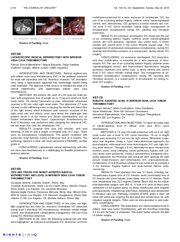 (PDF) V07-08 Laparoscopic Radical Nephrectomy with Inferior Vena Cava ...