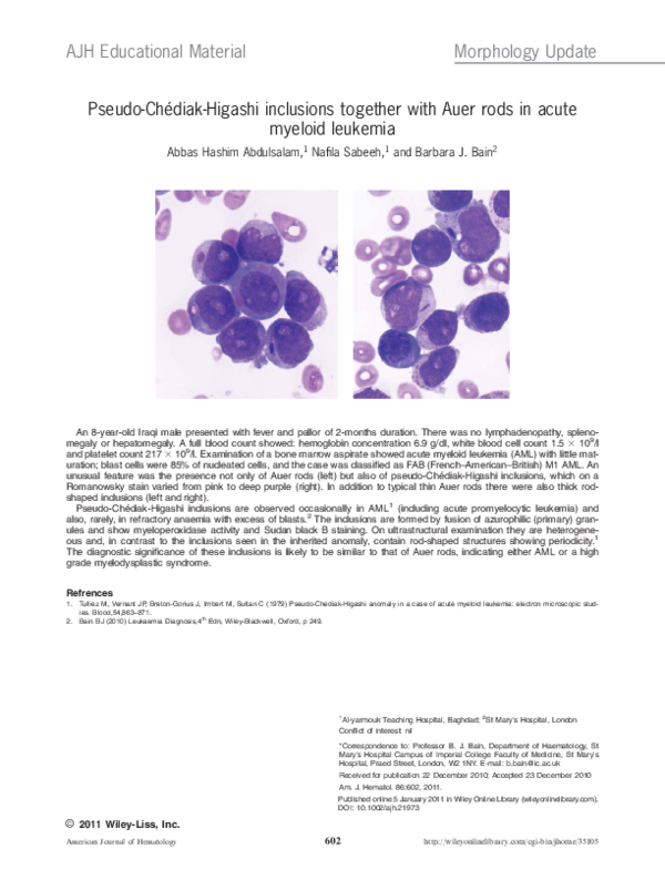 (PDF) Pseudo-Chédiak-Higashi inclusions together with Auer rods in ...