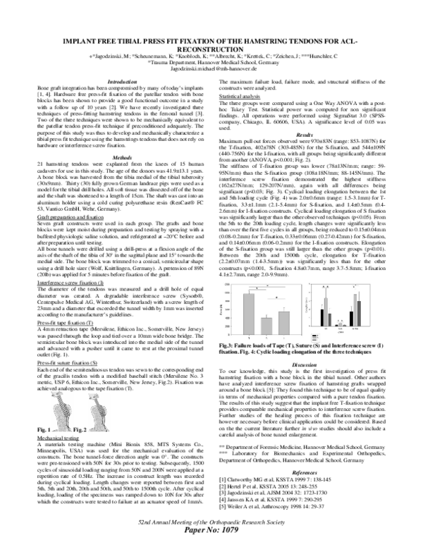 (PDF) Tibial press-fit fixation of the hamstring tendons for ACL ...
