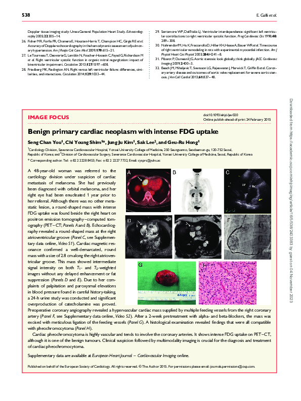 (PDF) Benign primary cardiac neoplasm with intense FDG uptake