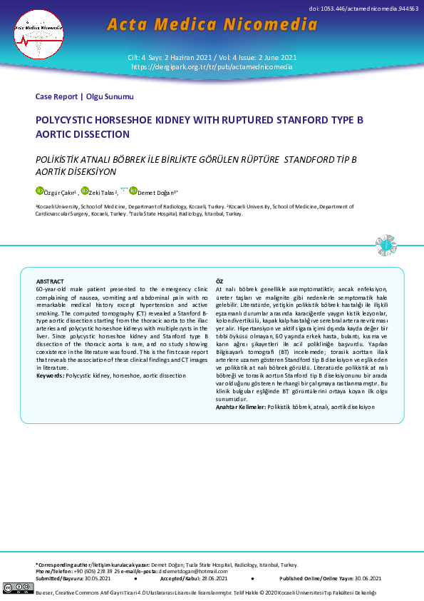 (PDF) Polycystic horseshoe kidney with ruptured Stanford type B aortic ...