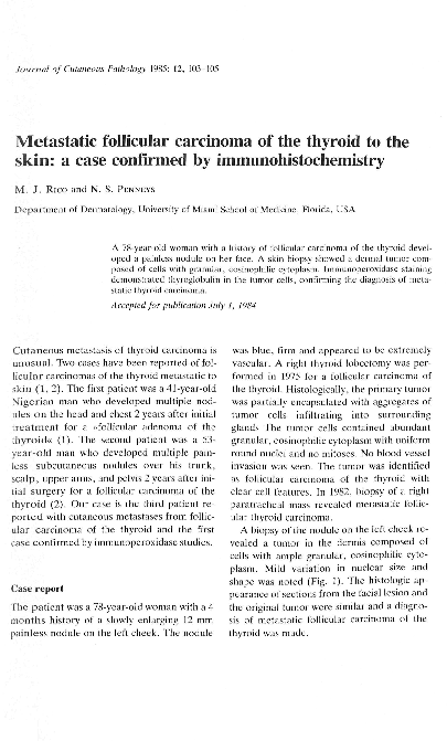(PDF) Metastatic follicular carcinoma of the thyroid to the skin: a ...