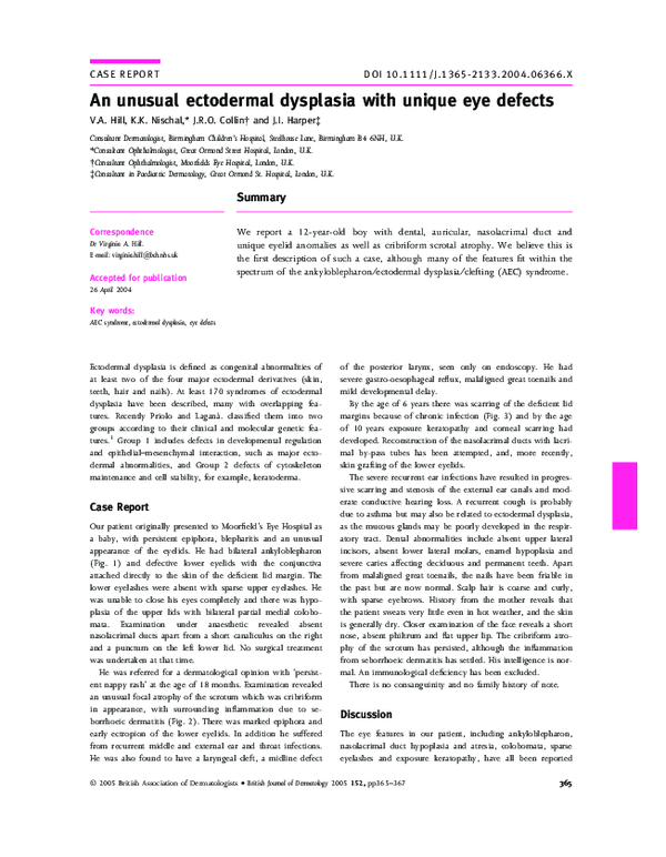 (PDF) An unusual ectodermal dysplasia with unique eye defects