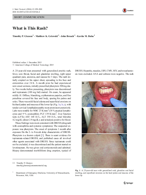 (PDF) What is This Rash?
