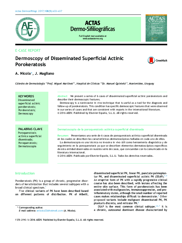 (PDF) Dermoscopy of disseminated superficial actinic porokeratosis in ...
