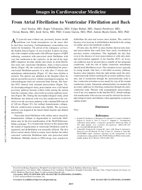 (PDF) From Atrial Fibrillation to Ventricular Fibrillation and Back