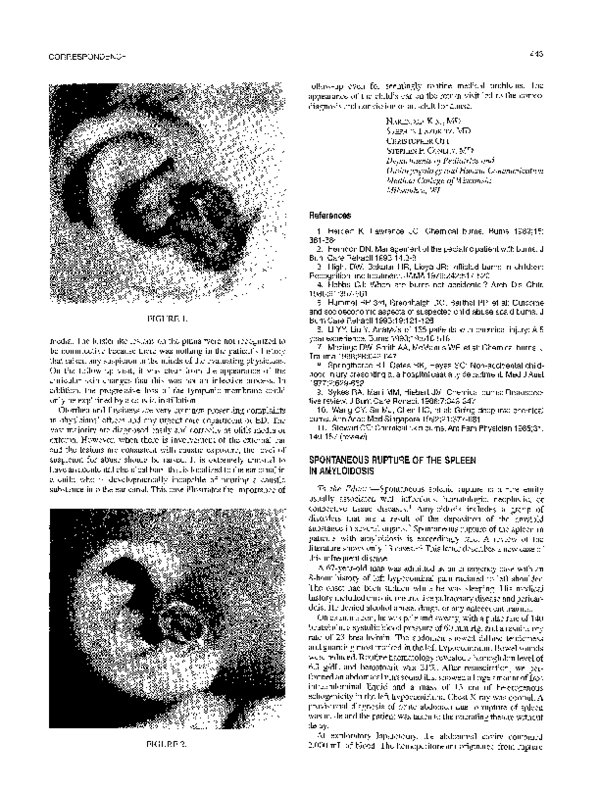 Pdf Spontaneous Rupture Of The Spleen In Amyloidosis Photo Inspiration